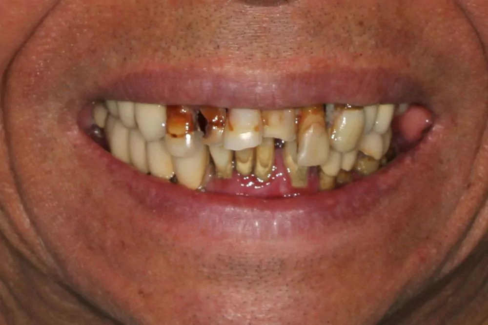 51